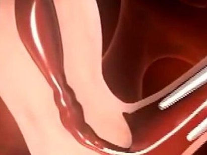 在襄阳做试管生孩子要多少钱？治疗流程是怎么样的？