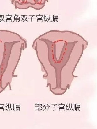 不孕不育该注意什么（不孕不育检查前需要注意什么）